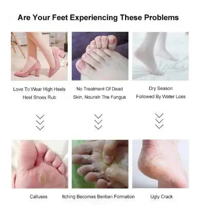 Rechargeable Electric Pedicure Tool – Callus & Dead Skin Remover